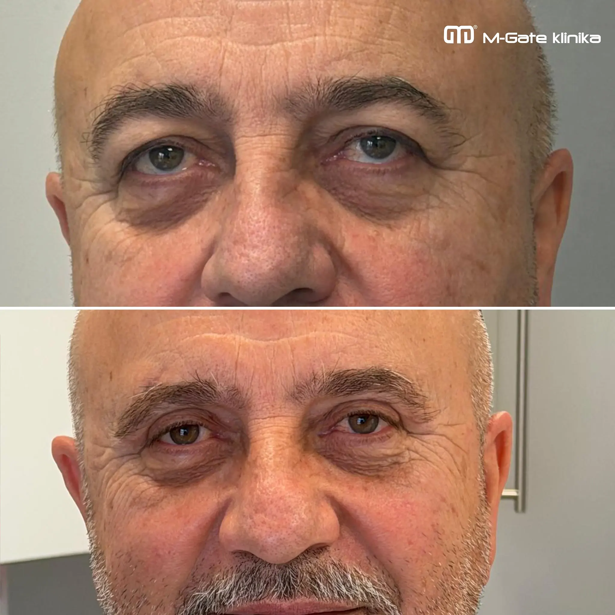 Operace víček - 19