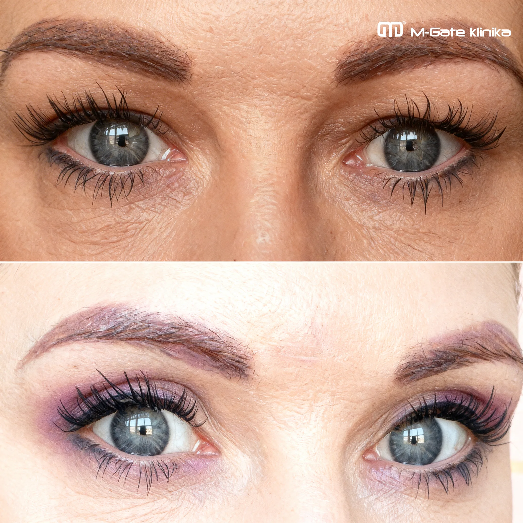 Operace víček - 17