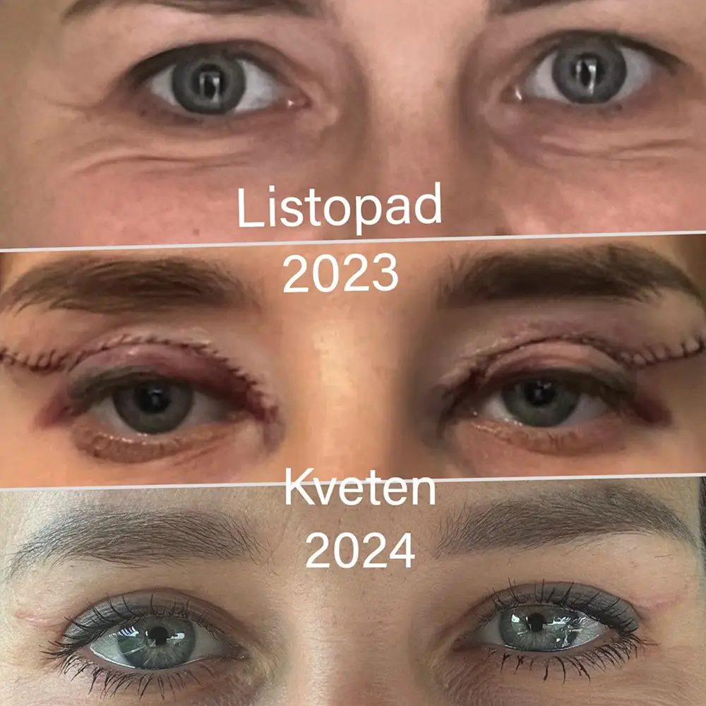 Romana Groh - Víčka