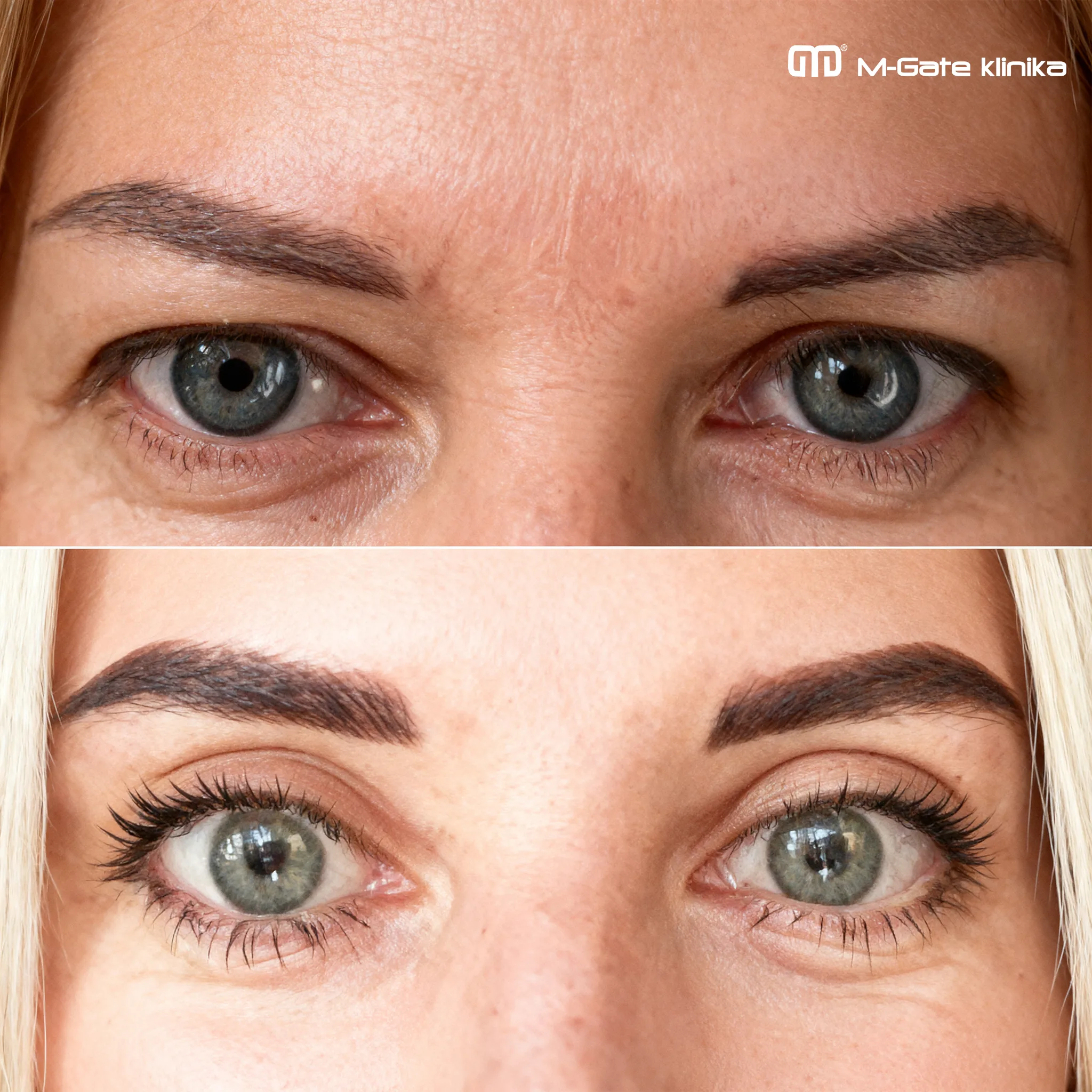 Operace víček - 10